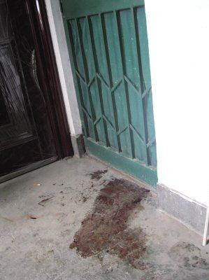 残忍!8个月女婴被姥姥剁掉双手 社会的悲哀